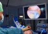 El Hospital de Úbeda incorpora una técnica para el tratamiento de roturas del manguito rotador